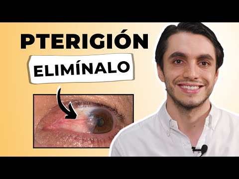 Guía detallada para la limpieza de basura en el ojo: métodos seguros y efectivos
