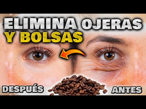 Consejos efectivos para disminuir la apariencia de las ojeras de manera rápida y natural