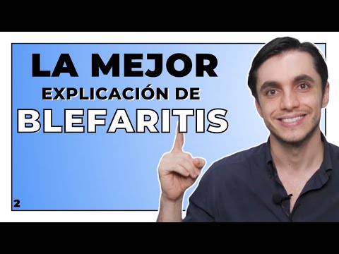 Conoce todo sobre el efecto pestañas: causas, síntomas y tratamientos